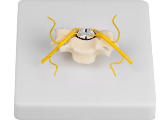 https://www.jayakelana.id.202-10-43-6.cpanel.site/uploads/product/-4067-vertebra-with-spinal-952539f2afe432b_cover.jpg
