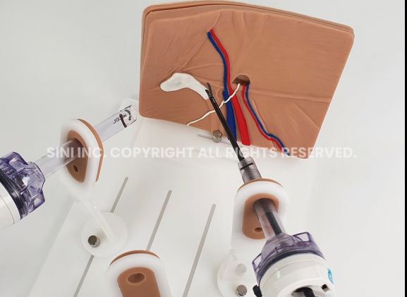 https://www.jayakelana.id.202-10-43-6.cpanel.site/uploads/product/-a-lph-01-laparoscopic-hernia-surgery-7117416c2979294_cover.jpg