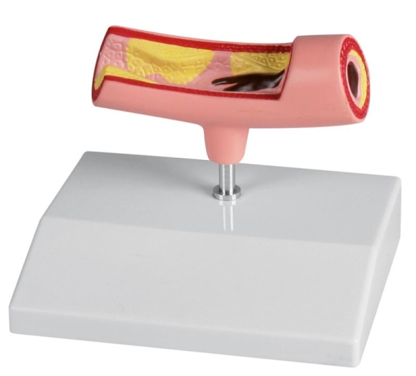 (G241) Artery Model
