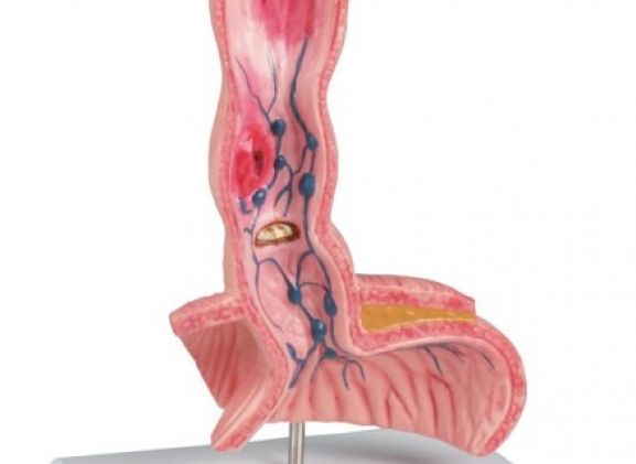 https://www.jayakelana.id.202-10-43-6.cpanel.site/uploads/product/-k218-oesophagus-diseases-91822f04ad01eaf_cover.jpg