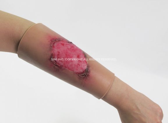 https://www.jayakelana.id.202-10-43-6.cpanel.site/uploads/product/-l-bur-01-burn-treatment-model-30229ee7a54c9c5_cover.jpg