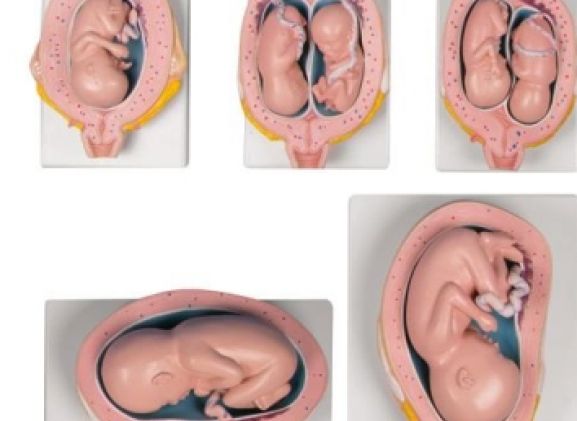 https://www.jayakelana.id.202-10-43-6.cpanel.site/uploads/product/-l204-pregnancy-model-set--3240079c3983ebe_cover.jpg