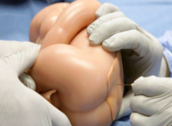 https://www.jayakelana.id.202-10-43-6.cpanel.site/uploads/product/-lpb-40-lumbar-puncture-baby-752626142266041_cover.png