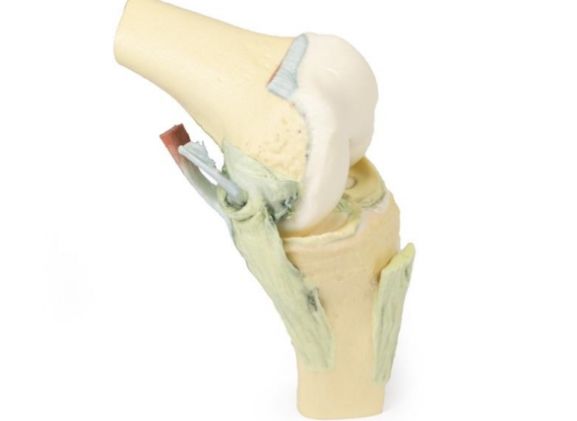 https://www.jayakelana.id.202-10-43-6.cpanel.site/uploads/product/-mp1800-knee-joint-flexed-89418a7b40730c5_cover.jpg