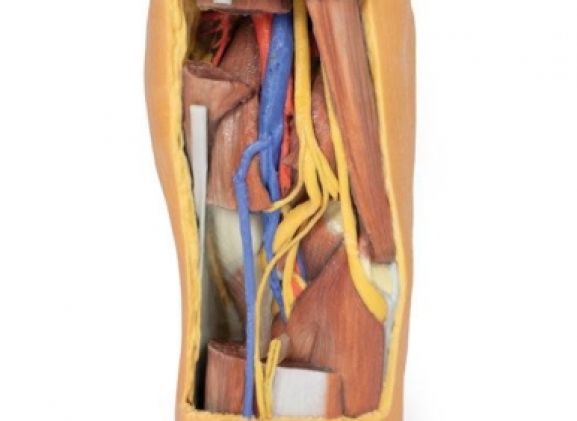 https://www.jayakelana.id.202-10-43-6.cpanel.site/uploads/product/-mp1820-popliteal-fossa-distal-7454066ff46504e_cover.jpg