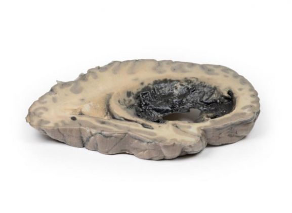 https://www.jayakelana.id.202-10-43-6.cpanel.site/uploads/product/-mp2002-cerebral-haemorrhage-15458a276d59e8c_cover.jpg