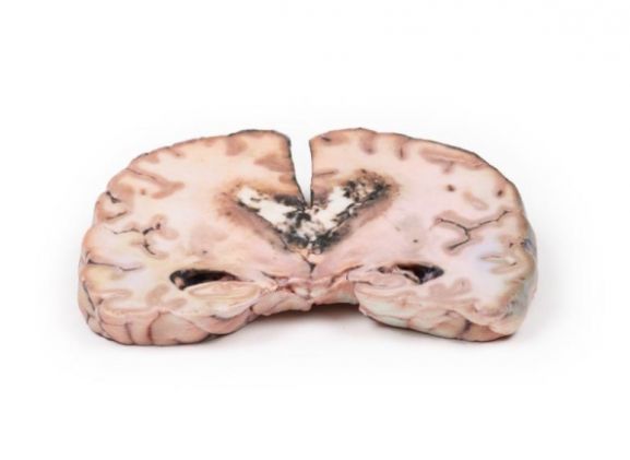 https://www.jayakelana.id.202-10-43-6.cpanel.site/uploads/product/-mp2003-glioma-grade-3-4--15959f8d55a3304_cover.jpg