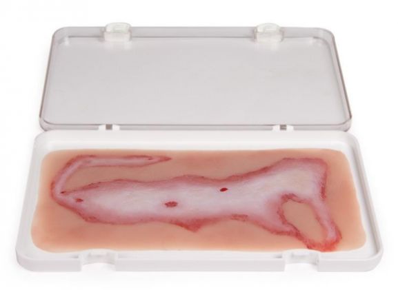 https://www.jayakelana.id.202-10-43-6.cpanel.site/uploads/product/-nw108-wound-moulage-scalding-878556fa9e7b542_cover.jpg