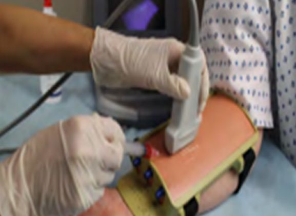 https://www.jayakelana.id.202-10-43-6.cpanel.site/uploads/product/deep-vessel-venipuncture-pad-8609356f54112d4_cover.png