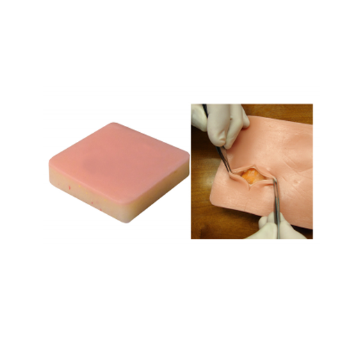 (LRP-10) LIPOMA PAD 