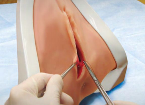 https://www.jayakelana.id.202-10-43-6.cpanel.site/uploads/product/perineal-repair-replaceable-tissue-12948e3954c122f_cover.png