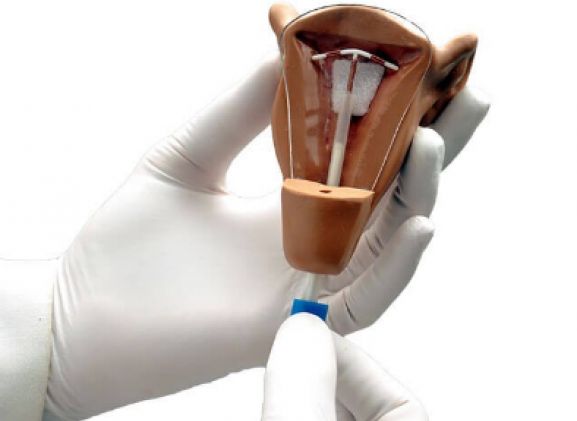 https://www.jayakelana.id.202-10-43-6.cpanel.site/uploads/product/uterus-i-iud-placement-64463ffb81dc10c_cover.png